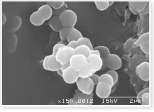 Pediococcus pentosaceus NB-17